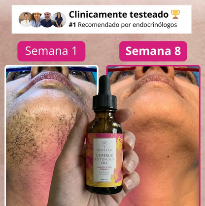 Cyperus OIL